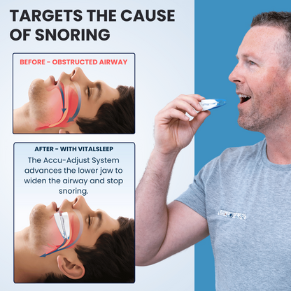 VitalSleep Adjustable Anti-Snoring Mouthpiece