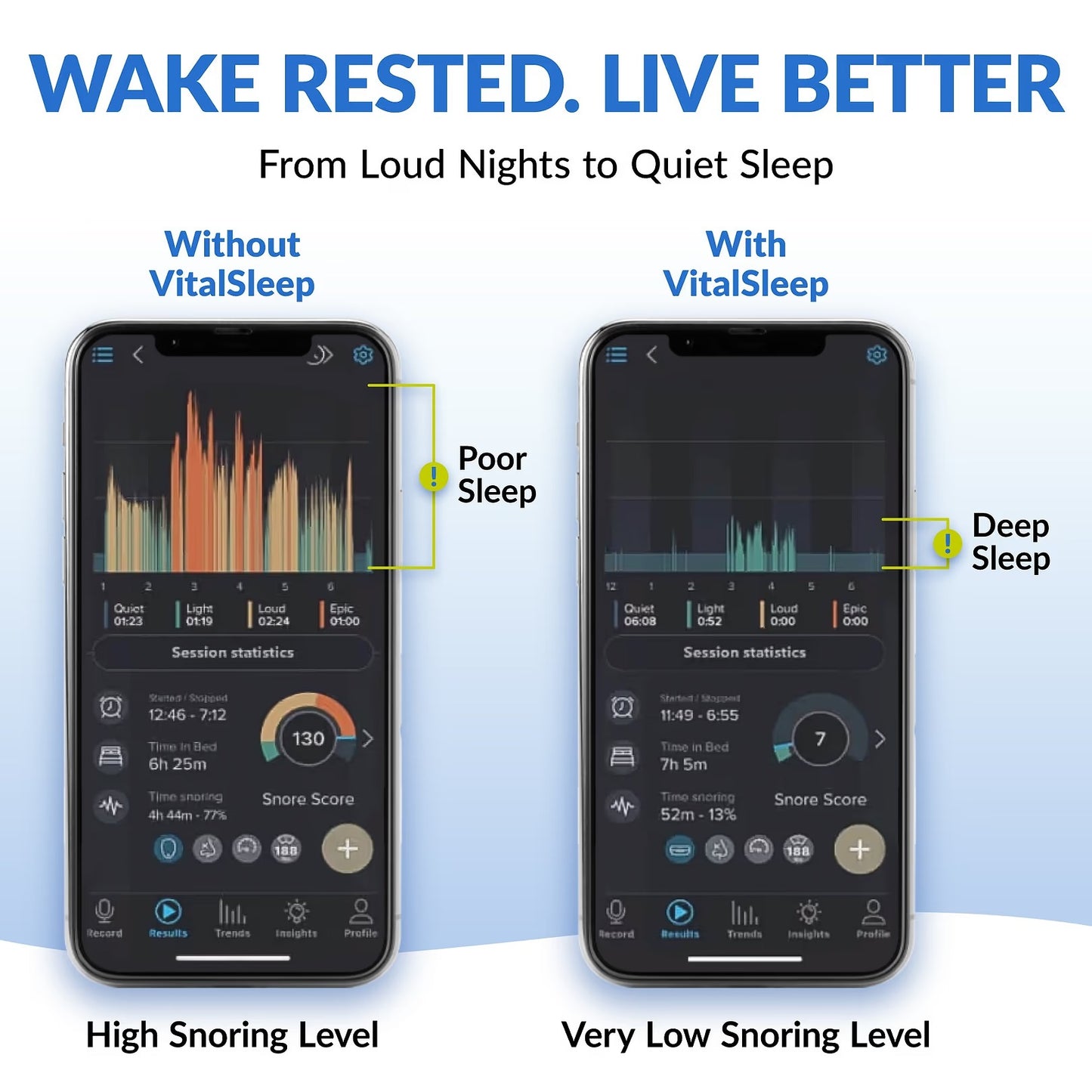 VitalSleep Adjustable Anti-Snoring Mouthpiece